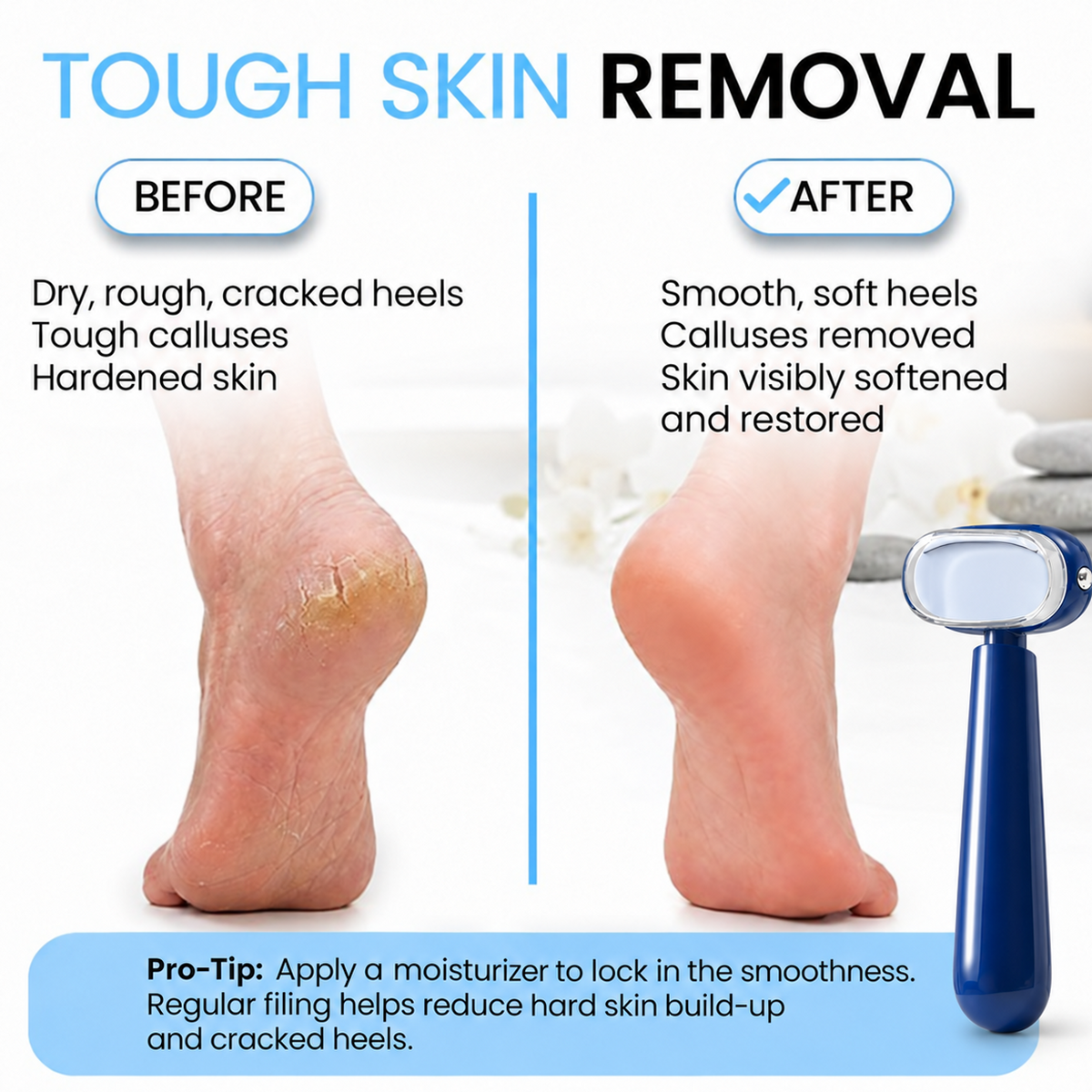 Dual‑Sided Foot Callus Remover, Replaceable Stainless Steel Blade Foot Scraper 🦶